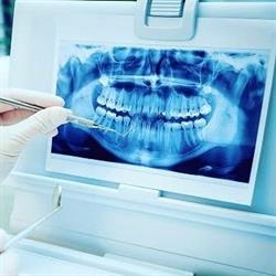 DentView Radiologie Dentara Digitala, Râmnicu Vâlcea program de funcționare