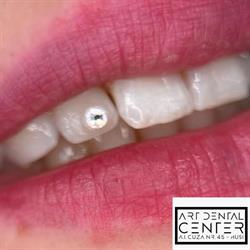 Art Dental Center, Huşi program de funcționare