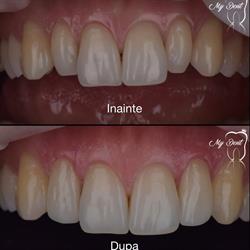 My Dent, Galaţi program de funcționare