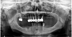 Dentist Mitrica, Craiova program de funcționare