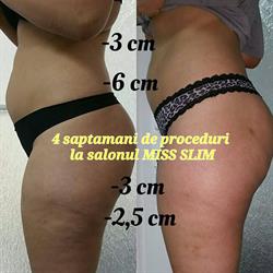 Miss Slim, Timişoara program de funcționare