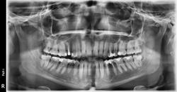 Radiologie Dentara Nasaud, program de funcționare