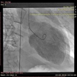 Cabinet Cardiologie Dr Vlad Ploscaru, Râmnicu Vâlcea program de funcționare