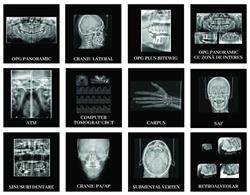 Centru de radiologie dentară Lugoj, program de funcționare
