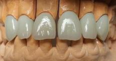 Laborator Dentar- DentaZ, Cluj-Napoca program de funcționare